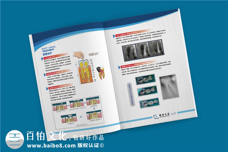 義齒產(chǎn)品宣傳手冊-義齒廠(chǎng)家圖冊假牙制造口腔修復公司畫(huà)冊設計