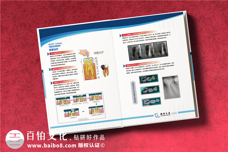 成都義齒產(chǎn)品宣傳畫(huà)冊設計-牙科技術(shù)開(kāi)發(fā)產(chǎn)品冊